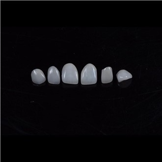 Emax porcelianinės faneros