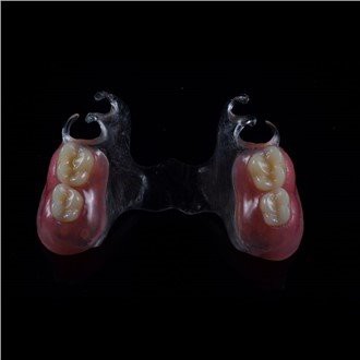 Nuimamas akrilo dalinis protezas